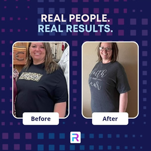 RZIP review results